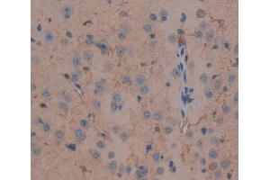 IHC-P analysis of brain tissue, with DAB staining. (DLG5 antibody  (AA 1724-1917))