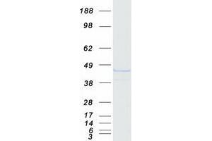 Validation with Western Blot