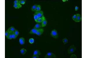 Immunofluorescence staining of HepG2 cells with ABIN7127390 at 1:33, counter-stained with DAPI. (Recombinant CCR9 antibody)
