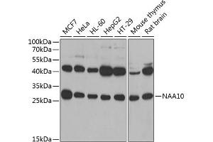 Western blot analysis of extracts of various cell lines, using N antibody (ABIN6129932, ABIN6144318, ABIN6144319 and ABIN6222781) at 1:1000 dilution. (NAA10 antibody  (AA 161-235))