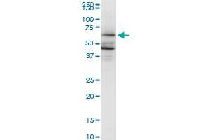 PAIP1 monoclonal antibody (M04), clone 2D11.