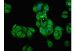 Immunofluorescence staining of HepG2 cells with ABIN7172695 at 1:100, counter-stained with DAPI. (TAF7L antibody  (AA 1-98))