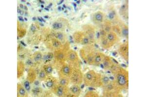 Used in DAB staining on fromalin fixed paraffin-embedded Liver tissue (GDF7 antibody  (AA 295-447))