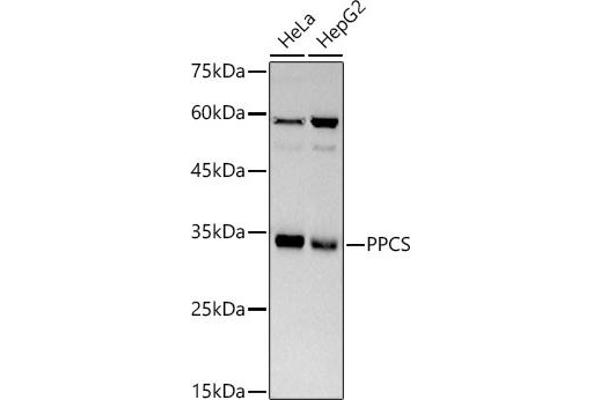 PPCS anticorps