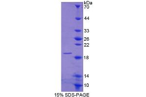 SDS-PAGE analysis of Human CNRIP1 Protein. (Cnrip1 Protein)