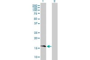 Western Blot analysis of SNAPIN expression in transfected 293T cell line by SNAPIN MaxPab polyclonal antibody. (SNAPIN antibody  (AA 1-136))