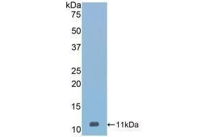 Detection of Recombinant Vaspin, Mouse using Polyclonal Antibody to Visceral Adipose Tissue Derived Serine Protease Inhibitor (Vaspin) (SERPINA12 antibody  (AA 71-148))