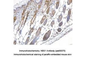 Image no. 1 for anti-NLR Family, Pyrin Domain Containing 2 (NLRP2) (AA 150-200) antibody (ABIN363677) (NLRP2 antibody  (AA 150-200))