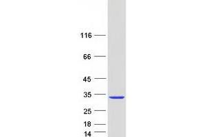 Validation with Western Blot