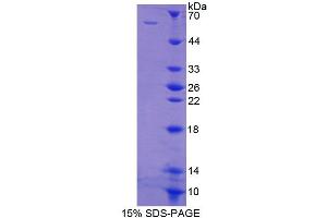 SDS-PAGE (SDS) image for Polypyrimidine Tract Binding Protein 1 (PTBP1) (AA 1-531) protein (His tag) (ABIN4989505) (PTBP1 Protein (AA 1-531) (His tag))