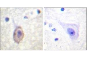 Immunohistochemistry (IHC) image for anti-Fms-Related tyrosine Kinase 1 (VEGFR1) (FLT1) (AA 1289-1338) antibody (ABIN2888714) (FLT1 antibody  (AA 1289-1338))