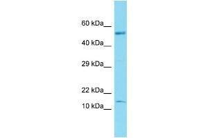 Host: Rabbit Target Name: C17orf103 Sample Type: Fetal Brain lysates Antibody Dilution: 1. (GTLF3B antibody  (N-Term))