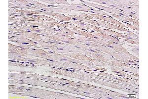 Formalin-fixed and paraffin embedded rat myocardium tissue labeled with Anti-Connexin-40 Polyclonal Antibody, Unconjugated (ABIN736926) at 1:200, followed by conjugation to the secondary antibody and DAB staining (Cx40/GJA5 antibody  (AA 301-358))