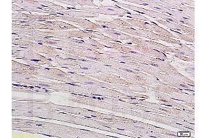 Formalin-fixed and paraffin embedded rat myocardium tissue labeled with Anti-Connexin-40 Polyclonal Antibody, Unconjugated (ABIN736926) at 1:200, followed by conjugation to the secondary antibody and DAB staining