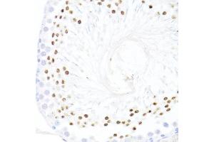Immunohistochemistry of paraffin-embedded rat testis using DDX59 antibody (ABIN7266702) at dilution of 1:100 (40x lens).