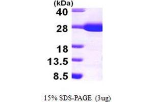 SDS-PAGE (SDS) image for rho GDP Dissociation Inhibitor (GDI) alpha (ARHGDIA) (AA 24-204) protein (His tag) (ABIN667259)