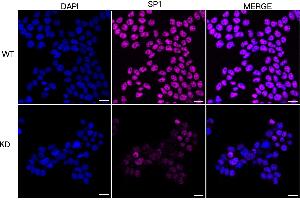 Immunocytochemical staining of HeLa cells using SP1 antibody (ABIN7800415), 1:1,000), Top panel: wild-type (WT), Bottom panal: SP1 shRNA knockdown (KD). (SP1 antibody)