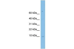 WB Suggested Anti-LSM6 Antibody Titration: 0. (LSM6 antibody  (Middle Region))