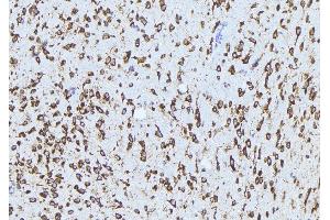 ABIN6272861 at 1/100 staining Mouse brain tissue by IHC-P. (ADAM12 antibody  (N-Term))