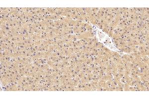 Detection of CEACAM1 in Human Liver Tissue using Monoclonal Antibody to Carcinoembryonic Antigen Related Cell Adhesion Molecule 1 (CEACAM1) (CEACAM1 antibody)