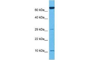 Western Blotting (WB) image for anti-Tumor Necrosis Factor Receptor Superfamily, Member 12A (TNFRSF12A) (N-Term) antibody (ABIN2784518)