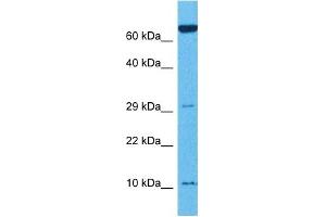 Host:  Rabbit  Target Name:  TNFRSF12A  Sample Tissue:  Mouse Thymus  Antibody Dilution:  1ug/ml (TNFRSF12A antibody  (N-Term))