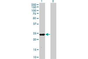 MXI1 antibody  (AA 73-182)