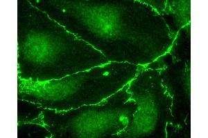 Immunofluorescence (IF) image for anti-DYKDDDDK Tag antibody (ABIN7453356) (DYKDDDDK Tag antibody)