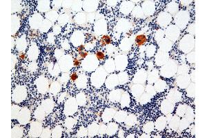 Immunohistochemistry (IHC) image for anti-Integrin Alpha2b (CD41) antibody (ABIN108423) (Integrin Alpha2b antibody)