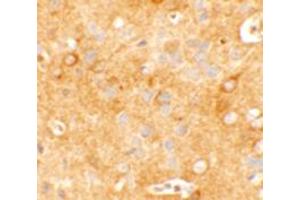 Immunohistochemical analysis of KCNK12 in mouse brain tissue with KCNK12 polyclonal antibody  at 5 ug/mL.