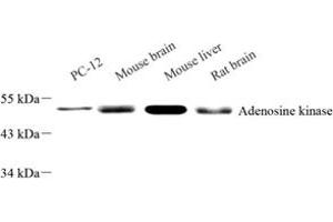 Western blot analysis of Adenosine kinase (ABIN7072953) at dilution of 1: 1000