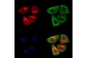ABIN7094684 and ABIN7098735 staining Hela cells by IF/ICC.