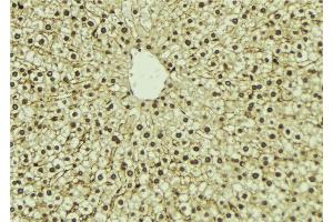 ABIN6273298 at 1/100 staining Mouse liver tissue by IHC-P.
