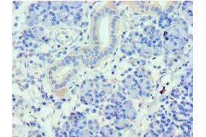 Immunohistochemistry of paraffin-embedded human pancreatic tissue using ABIN7159661 at dilution of 1:100 (WDR77 antibody  (AA 1-260))