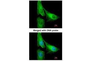 ICC/IF Image Immunofluorescence analysis of paraformaldehyde-fixed HeLa, using CENTG2, antibody at 1:200 dilution. (AGAP1 antibody  (C-Term))