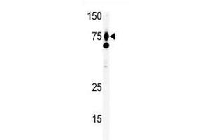 Image no. 1 for anti-Hepatocyte Growth Factor (Hepapoietin A, Scatter Factor) (HGF) (C-Term) antibody (ABIN357192) (HGF antibody  (C-Term))