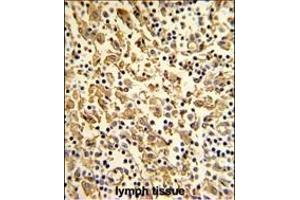 Formalin-fixed and paraffin-embedded human lymph with XPOT Antibody (N-term), which was peroxidase-conjugated to the secondary antibody, followed by DAB staining. (XPOT antibody  (N-Term))