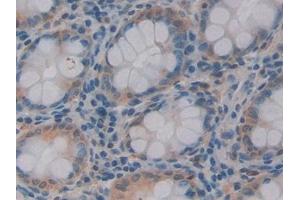 Used in DAB staining on fromalin fixed paraffin- embedded Kidney tissue (REG3g antibody  (AA 87-175))