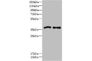 Western blot All lanes: FPR1 antibody at 6 μg/mL Lane 1: Colo320 whole cell lysate Lane 2: HT29 whole cell lysate Secondary Goat polyclonal to rabbit IgG at 1/10000 dilution Predicted band size: 39 kDa Observed band size: 39 kDa