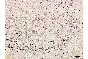 Formalin-fixed and paraffin embedded rat brain labeled with Rabbit Anti-CDK5 Polyclonal Antibody (ABIN670101) at 1:200 followed by conjugation to the secondary antibody and DAB staining. (CDK5 antibody  (AA 15-100))