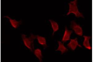 ABIN6269338 staining HeLa by IF/ICC. (FOXO1 antibody  (Internal Region))