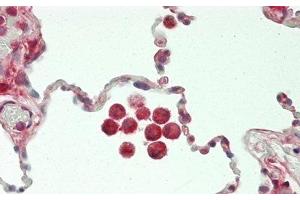 Immunohistochemistry (IHC) image for anti-Chitinase 3-Like 1 (Cartilage Glycoprotein-39) (CHI3L1) (AA 112-377) antibody (ABIN7433657)