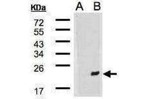 WB Image Western Blot analysis of DNAJB9 expression in transfected 293T cell line by DNAJB9 polyclonal antibody. (DNAJB9 antibody  (C-Term))