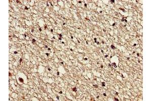 Immunohistochemistry of paraffin-embedded human brain tissue using ABIN7175666 at dilution of 1:100 (VPS16 antibody  (AA 7-89))