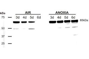 Western Blotting (WB) image for anti-Phosducin (PDC) antibody (ABIN619539) (Phosducin antibody)