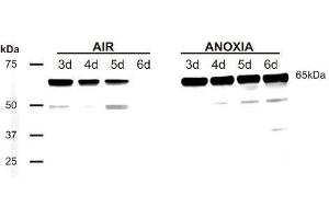 Western Blotting (WB) image for anti-Phosducin (PDC) antibody (ABIN619539)