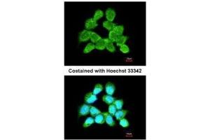 ICC/IF Image Immunofluorescence analysis of methanol-fixed A431, using LARS2, antibody at 1:200 dilution. (LARS2 antibody)
