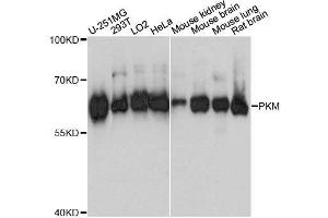 Western blot analysis of extracts of various cell lines, using PKM antibody. (PKM antibody  (AA 11-221))