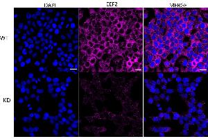 Immunocytochemical staining of HeLa cells using Eukaryotic translation elongation factor 2 antibody (ABIN7798502), 1:1,000), Top panel: wild-type (WT), Bottom panal: Eukaryotic translation elongation factor 2 shRNA knockdown (KD).