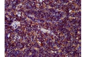 IHC image of ABIN7147311 diluted at 1:400 and staining in paraffin-embedded human lymph node tissue performed on a Leica BondTM system. (CDCA7L antibody  (AA 14-167))